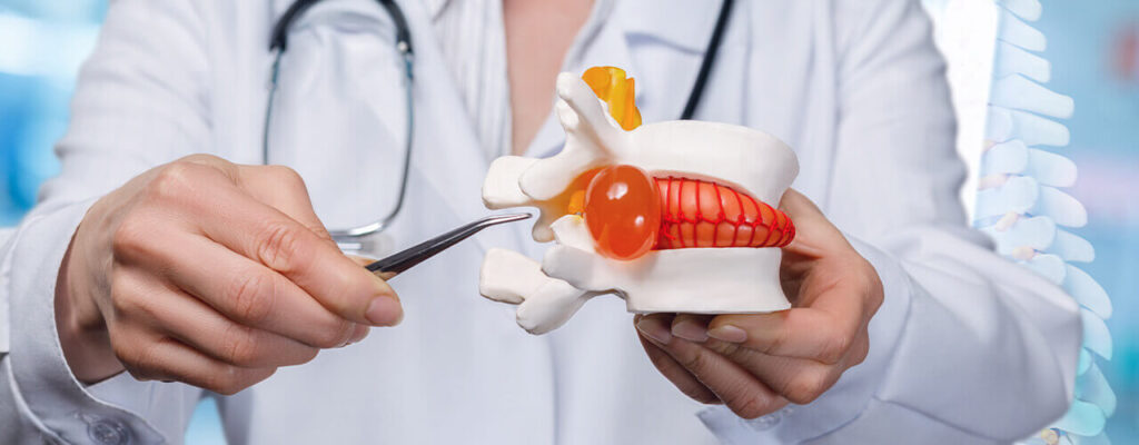 When Should You Visit a Doctor for Herniated Disc Pain?