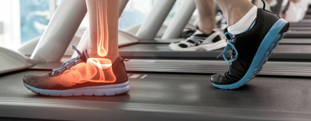 Ankle pain