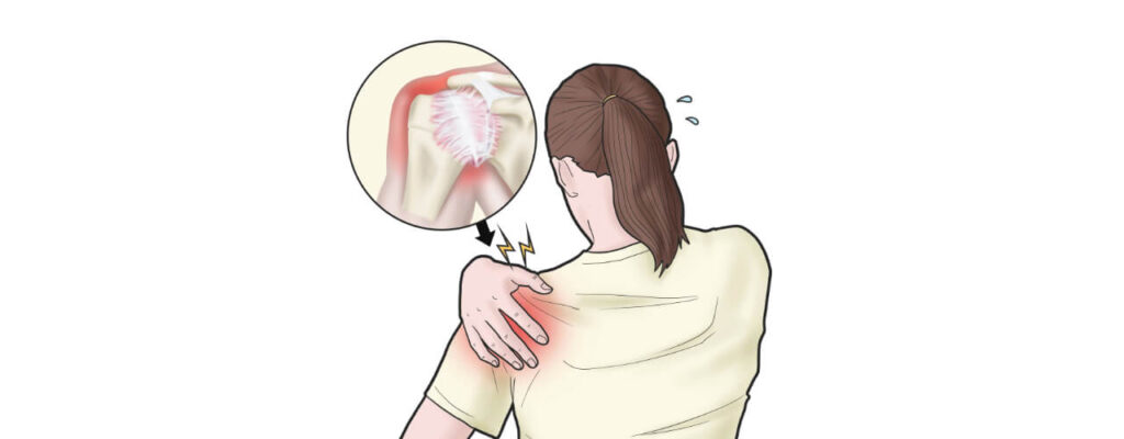 Shoulder pain